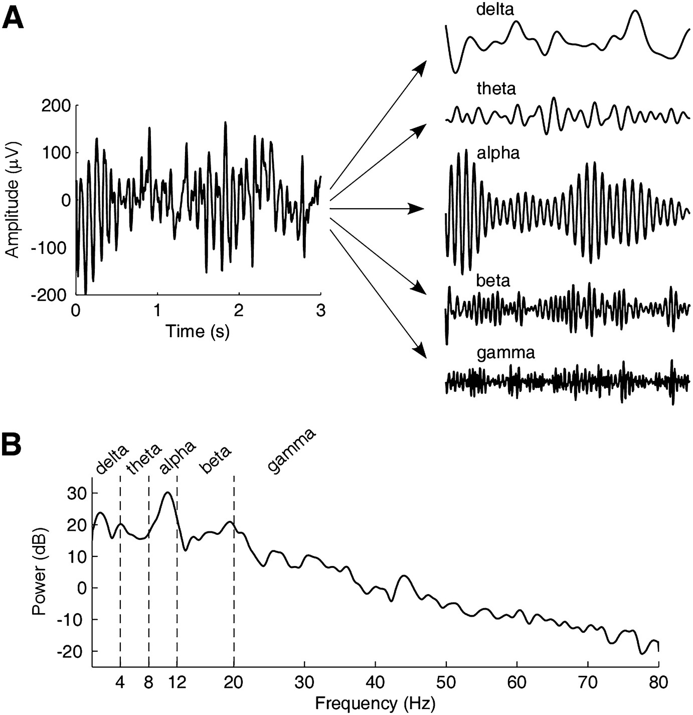 EEG signal and bands